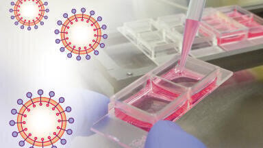 Worldwide Support for Virology Research Announced