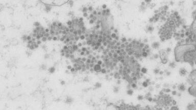 Images Advance Understanding of SARS-CoV-2 Gut Infection Activity