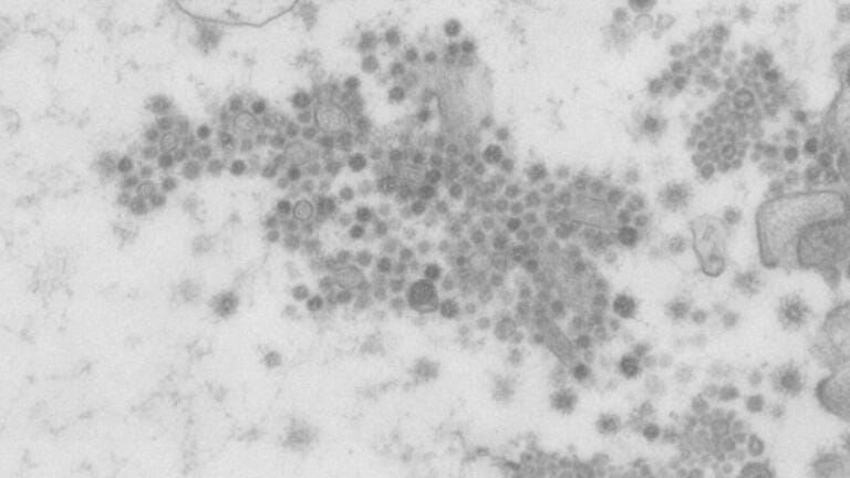 Images Advance Understanding of SARS-CoV-2 Gut Infection Activity