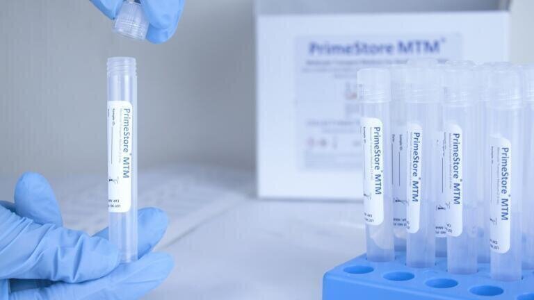 COVID-19 Sample Collection Kit Manufacturing and Supply Contracts Announced