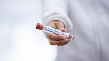 Can You Test for Previous COVID-19 Exposure?