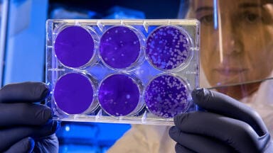 Fighting Viral Outbreaks with Rapid Point-of-Care Testing using Screen-printed Electrodes