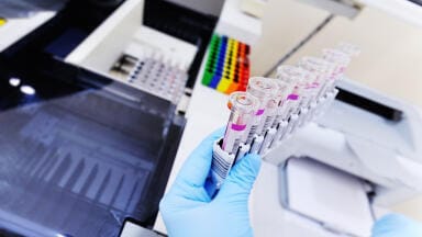 Rapid COVID-19 Diagnostic Infection Testing