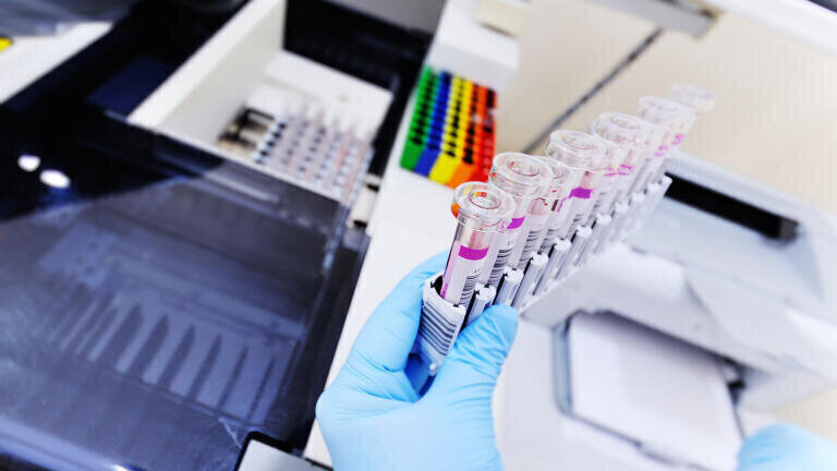 Rapid COVID-19 Diagnostic Infection Testing