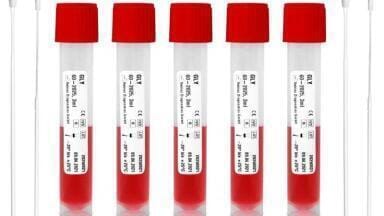 Peristaltic Pump Increases COVID-19 Sampling Kit Production