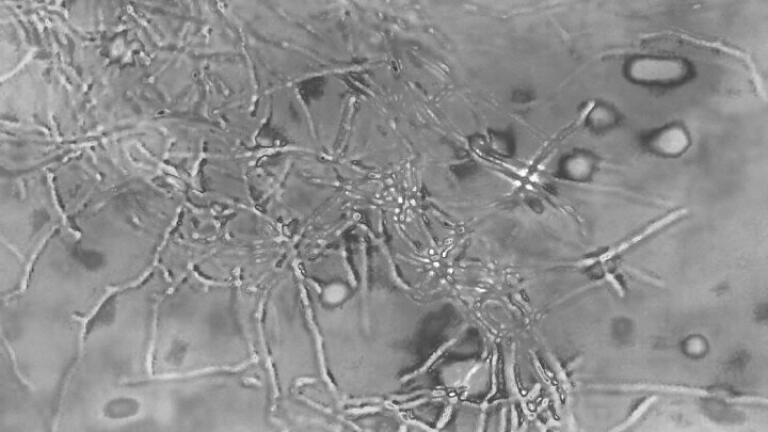 Researchers on Discovery Trail for first Covid-19 Antiviral Drug