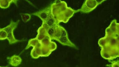 New Antibodies for COVID-19 Virus Detection