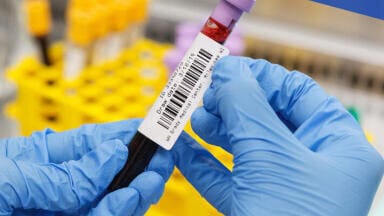 Fully automated label printing in a laboratory