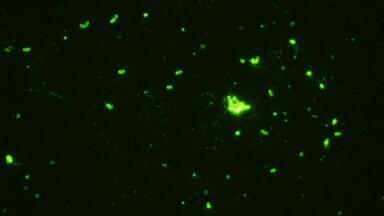 New Monoclonal Antibodies to Clostridia GDH
