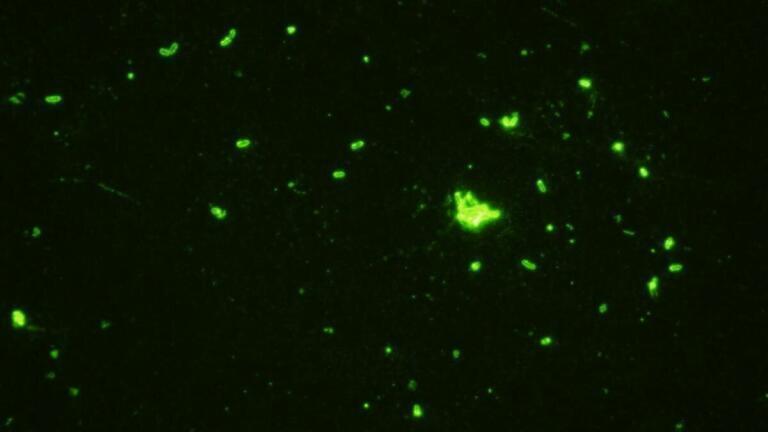 New Monoclonal Antibodies to Clostridia GDH