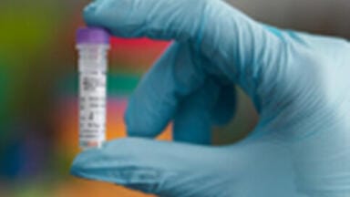PCR Biosystems launches RiboShield™ RNase Inhibitor for reliable RNA protection