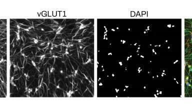 Powerful Human iPSC-derived Cells, Kits and Services