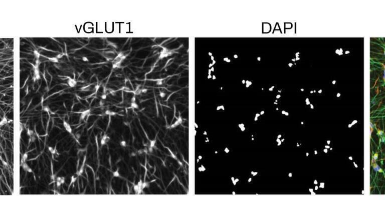 Powerful Human iPSC-derived Cells, Kits and Services