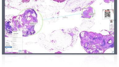 Next Generation Digital Pathology