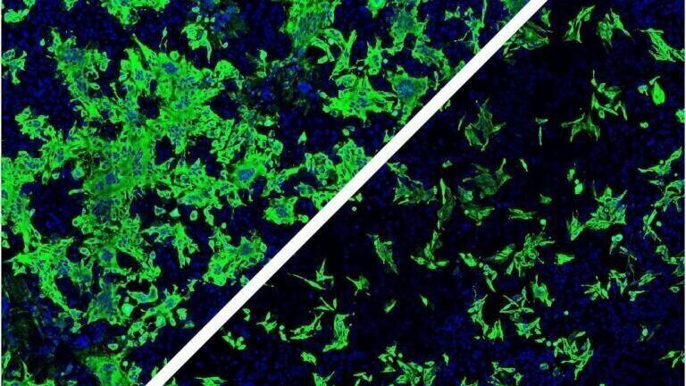 Host Factor Discovery points to Potential SARS-CoV-2 Therapies
