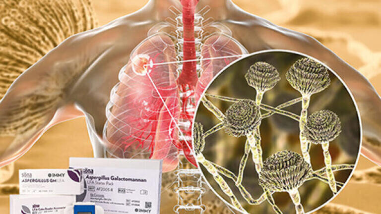 Invasive Aspergillosis Screening in COVID-19 and Critical Care Patients