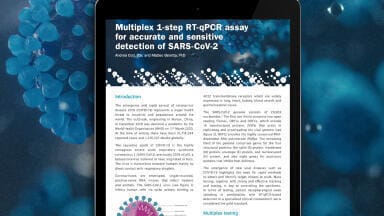 RT-qPCR Assay Optimised for Multiplexed SARS-CoV-2 and Winter Virus Tests