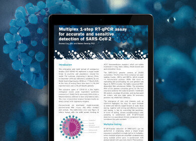 RT-qPCR Assay Optimised for Multiplexed SARS-CoV-2 and Winter Virus Tests