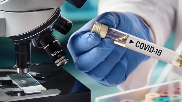 Queen’s to Investigate Coronavirus Blood Vessel Damage