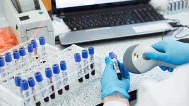 On Demand Print Flexibility in the Laboratory