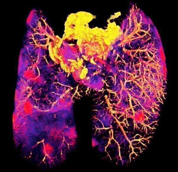 Imaging Method reveals whether Antibiotics reach Bacteria hiding in Tissues - Vimarsana News