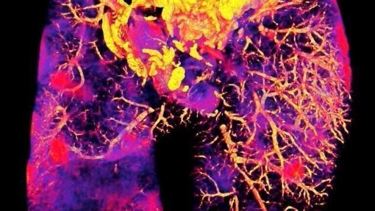 Imaging Method reveals whether Antibiotics reach Bacteria hiding in Tissues