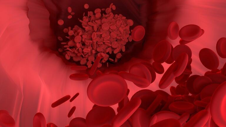 How Has Stroke Treatment Changed?