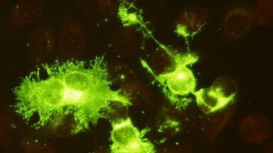 Validated Antibody Pairs for Respiratory Pathogen Detection