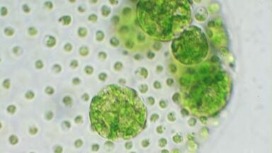 Microscopic Photography re-focuses on Importance of Algae
