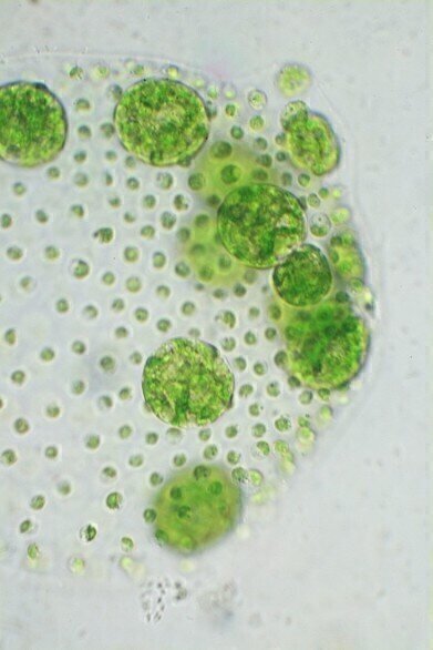 Microscopic Photography re-focuses on Importance of Algae