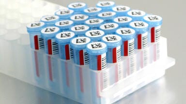 The Importance of a Quality Laboratory Label