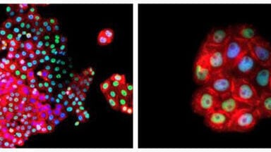 Patient-Derived Human Primary Cancer Cells