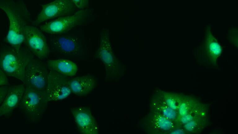 Photo of Samsara lead compound showing increased autophagy (green dots) in human cells.