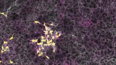 Study highlights Evolutionary Aspect of Tumour Development