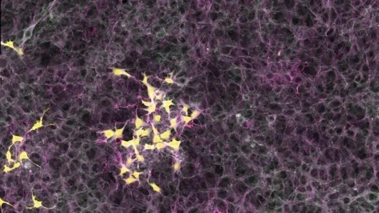 Study highlights Evolutionary Aspect of Tumour Development