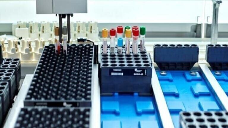 Workflow Automation Solutions for Mid-volume Laboratories Introduced ...