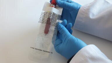How are Specimen Tubes Transported Safely and Economically?