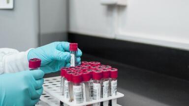 Automated Sample Handling and Preparation Methods - A Complete Guide