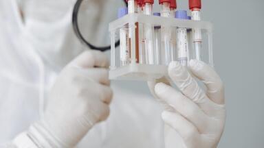 Types of Sample Used in Laboratories