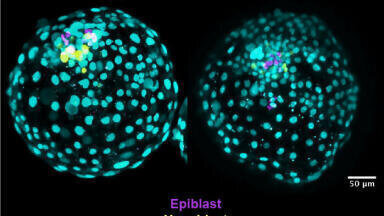 Fertility Research - Can Stem Cells provide Embryo Models?