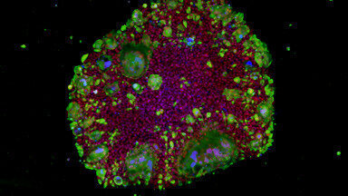 Are genetic differences the primary reason for susceptibility and severity of COVID-19?