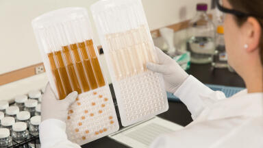 Legionnaires` Disease Outbreaks: Prevention and Control Methods