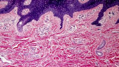 FFPE Tissue Blocks: Normal and Disease-State