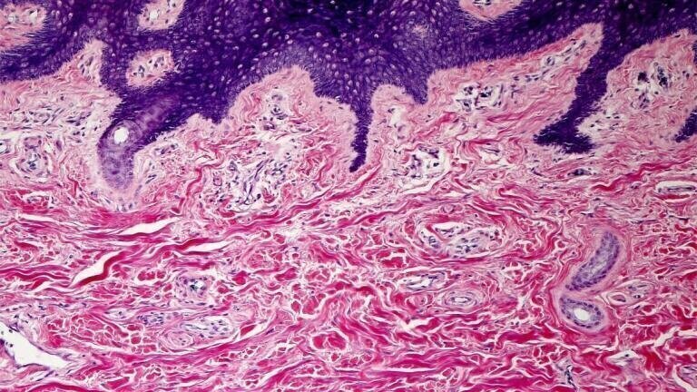 FFPE Tissue Blocks: Normal and Disease-State