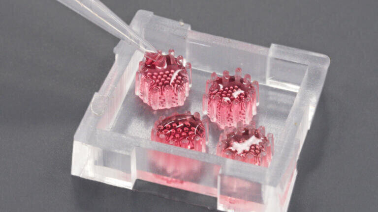 Organ Model heralds first insights into Early Diagnosis of PDAC