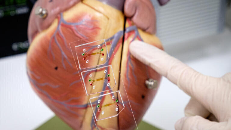 A microfluidic 3D model of the human blood vessel has been developed by NTU and TTSH scientists to study atherosclerosis in blood vessels and coronary arteries. Credit NTU Singapore