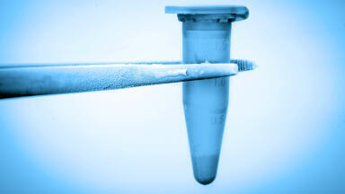 Cryopreservation Excipient for Cell Therapies: Maximise Cell Viability and Recovery