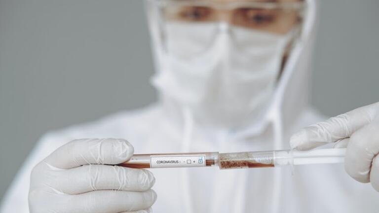 What is CSF Sample Processing?