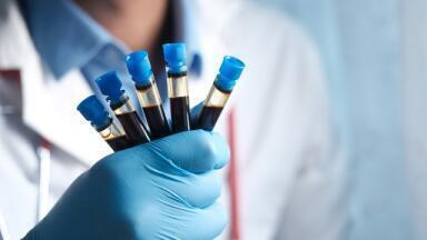 What Are the Different Types of PK Sample?