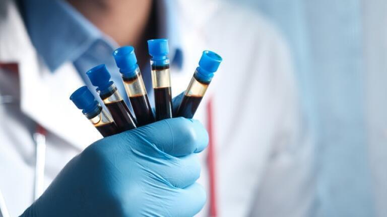 What Are the Different Types of PK Sample?